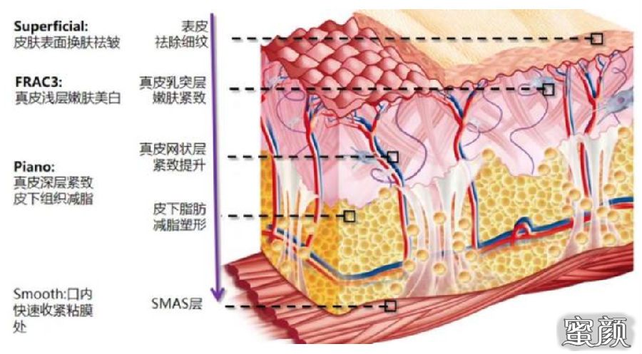 https://img.miyanlife.com/mnt/Editor/2022-11-28/63846cb6649b9.jpg