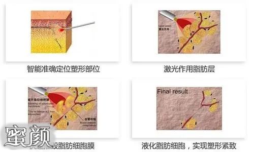 案例图片