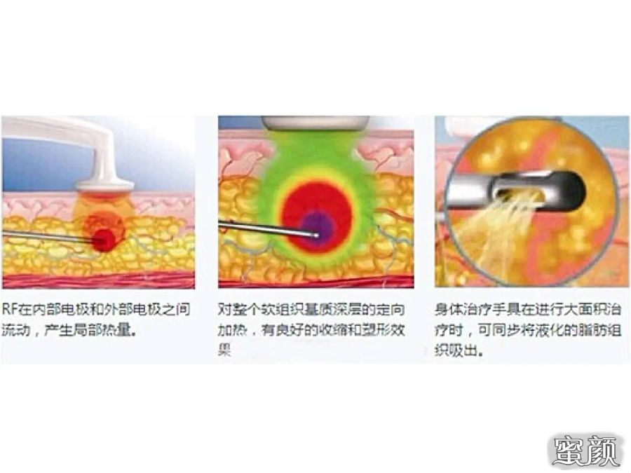 案例图片