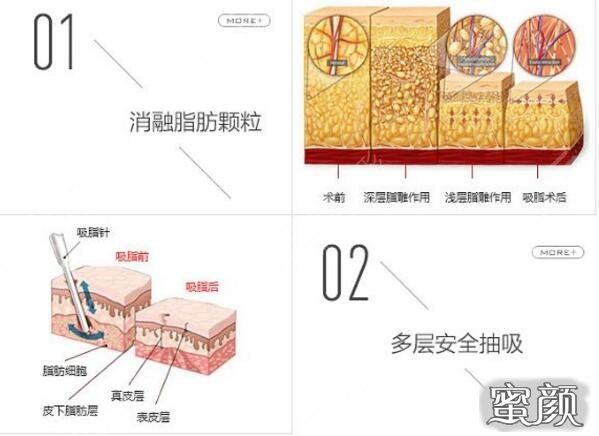 案例图片