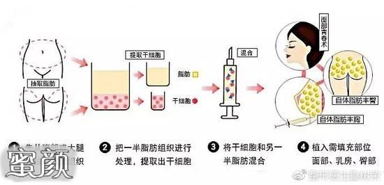 案例图片