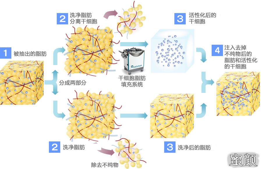 案例图片