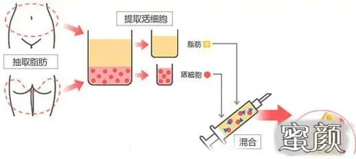 案例图片