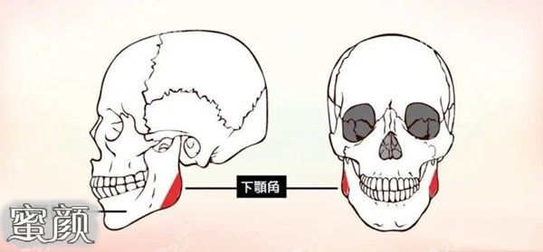 案例图片