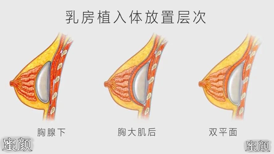 案例图片