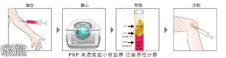 案例图片