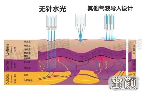 案例图片