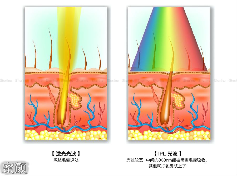 案例图片