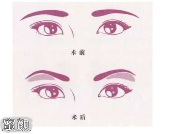 https://img.miyanlife.com/mnt/Editor/2023-03-04/6403304bea45b.jpg