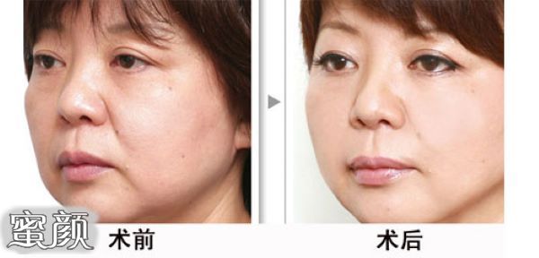 https://img.miyanlife.com/mnt/Editor/2023-03-05/6404a837d4a06.jpg