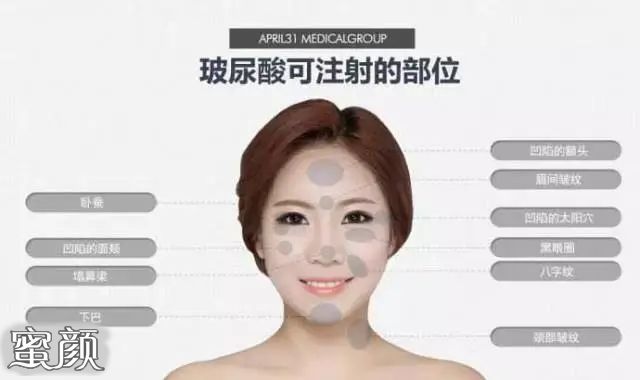 https://img.miyanlife.com/mnt/Editor/2023-03-06/64058c27e5ff5.jpg
