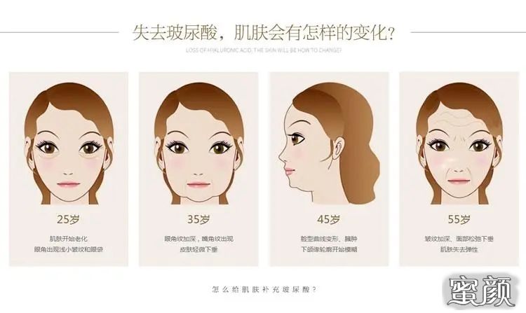 https://img.miyanlife.com/mnt/Editor/2023-03-06/64058c3080a8e.jpg