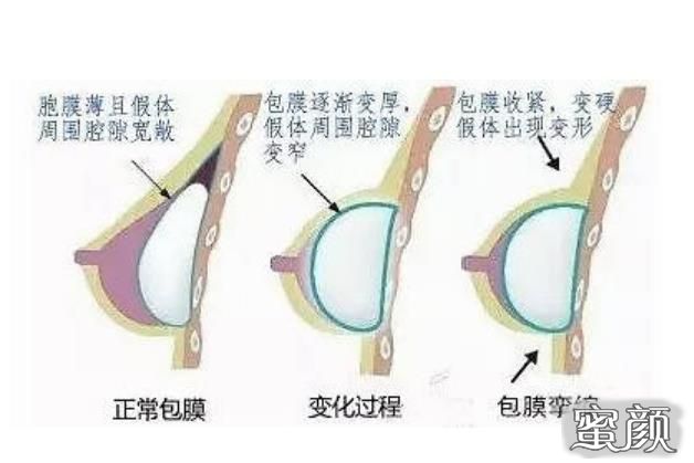 案例图片