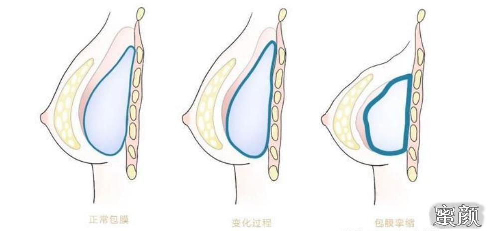 案例图片