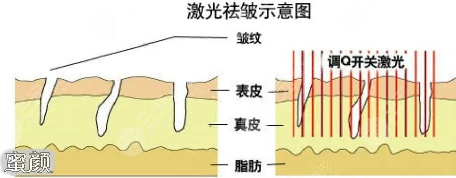 案例图片