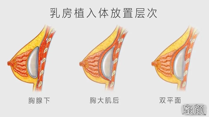 案例图片