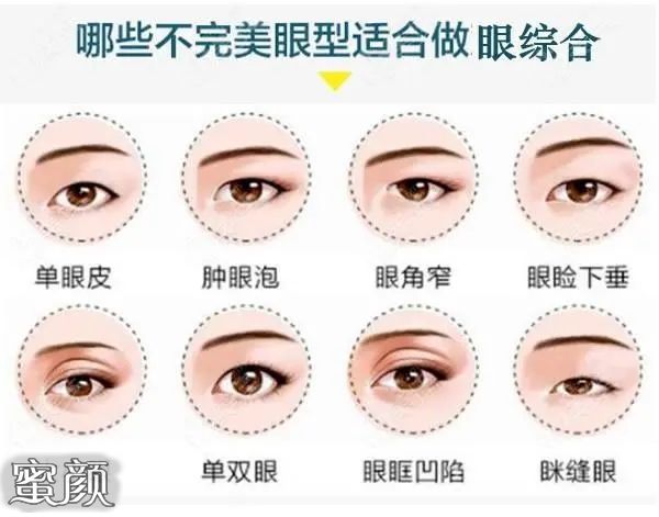 https://img.miyanlife.com/mnt/Editor/2023-03-10/640ae885a2739.jpg