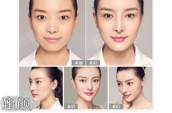 https://img.miyanlife.com/mnt/Editor/2023-03-10/640ae88fb674e.jpg