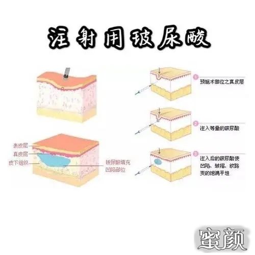 案例图片