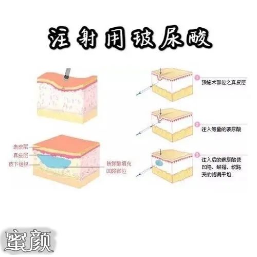 案例图片