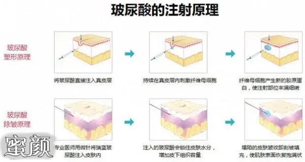 案例图片