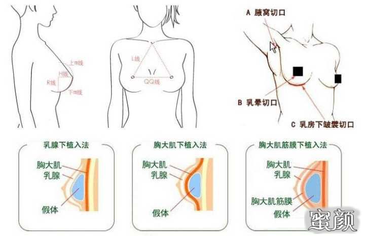 案例图片