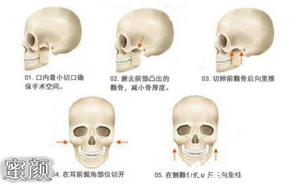 案例图片