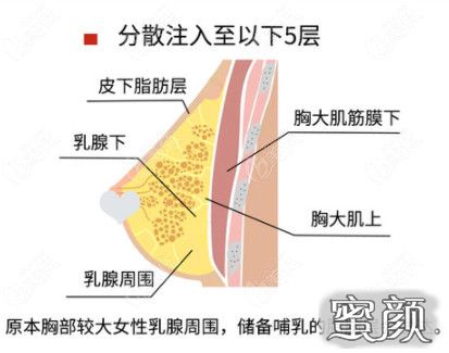 案例图片