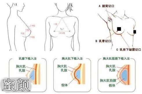 案例图片