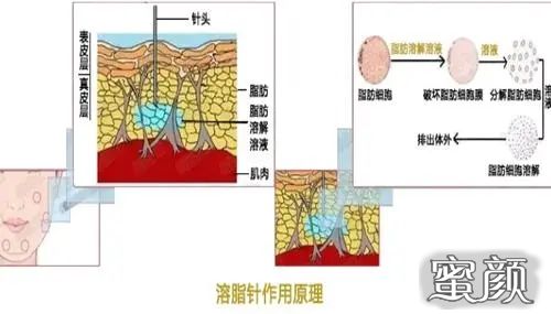 案例图片