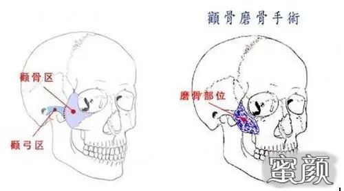 案例图片