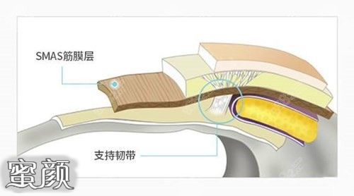 案例图片