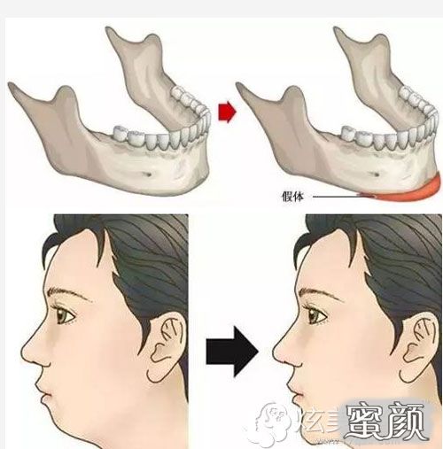 案例图片