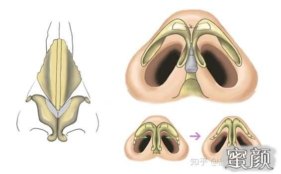 案例图片