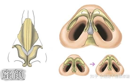 案例图片