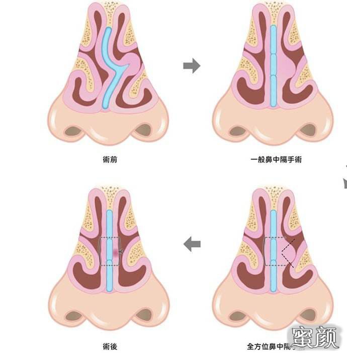 案例图片