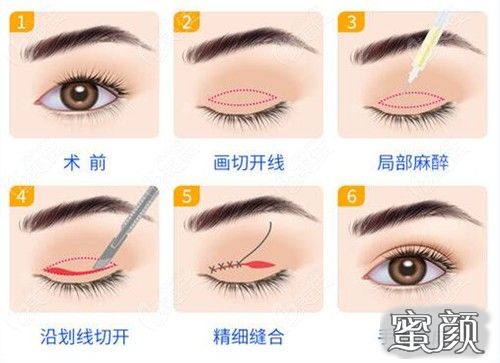 https://img.miyanlife.com/mnt/Editor/2023-04-23/6444c91c20dc9.jpg