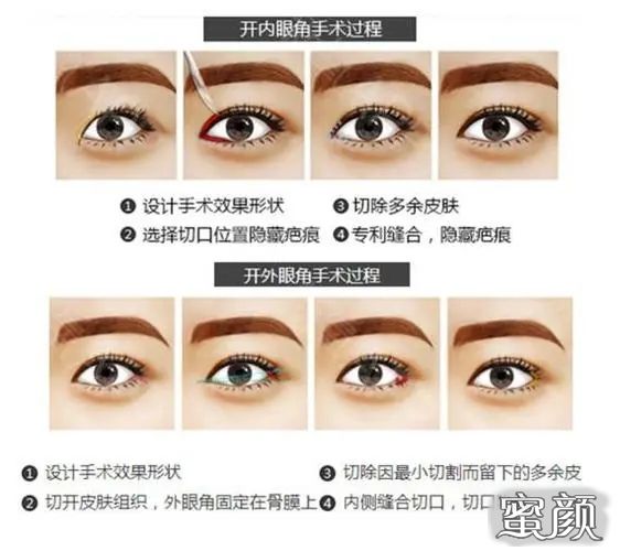 https://img.miyanlife.com/mnt/Editor/2023-04-23/6444c9247d77b.jpg