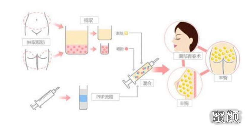 案例图片