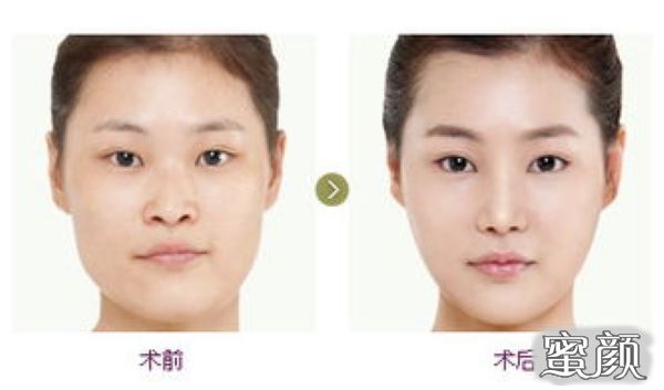 https://img.miyanlife.com/mnt/Editor/2023-05-04/645306565e14f.jpg