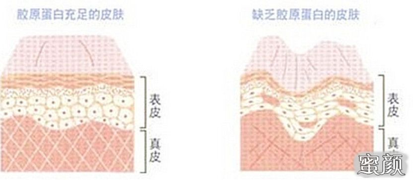 案例图片