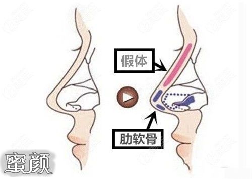 案例图片