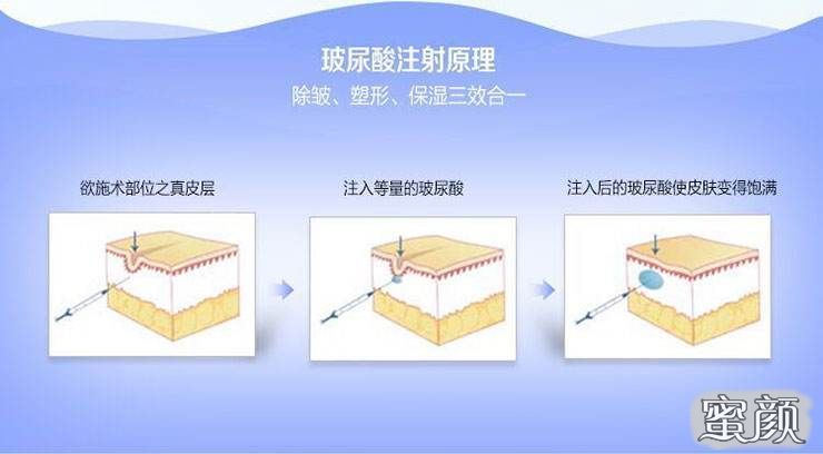 案例图片