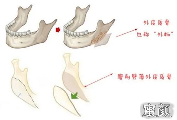 案例图片