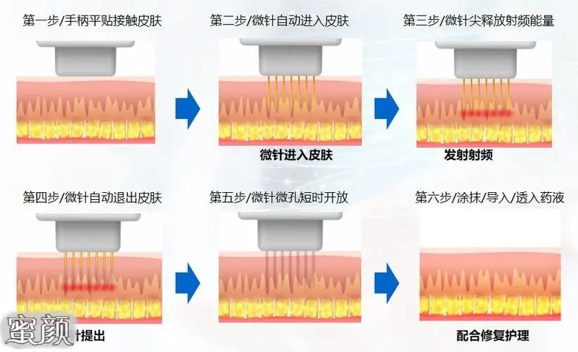 案例图片