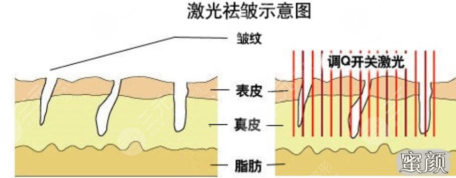 https://img.miyanlife.com/mnt/Editor/2023-08-15/64db1df08e270.jpg