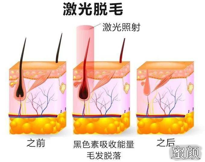 案例图片