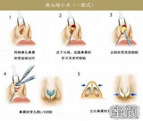 案例图片