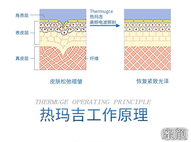 案例图片