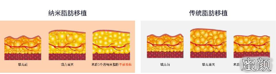 案例图片